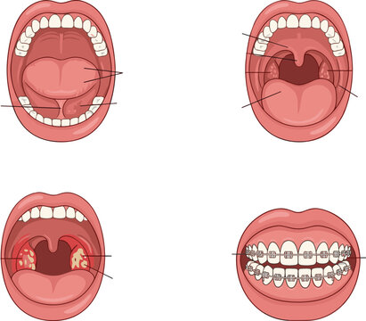 Human mouths with various dental and oral health conditions teeth tongue lips orthodontic braces