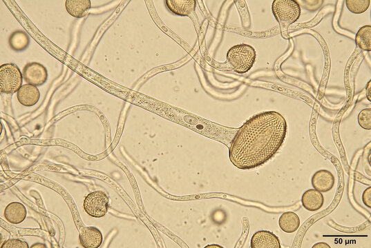 Microscopic observation of pollen grain germination
