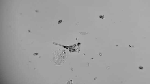 Microscopic view of black mold spores