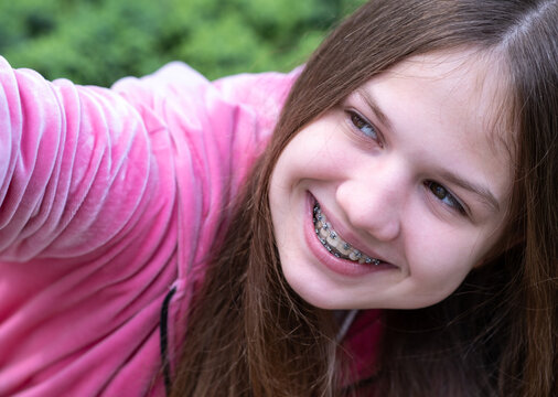 Smiling teen girl with dental braces taking selfie outdoors in summer park. Teeth health care, orthodontic treatment concept