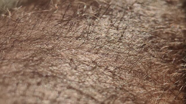 Extreme close-up shows detailed texture of human skin as piloerection causes tiny hairs to stand. This biological reaction reflects a response to cold or emotional stimuli.