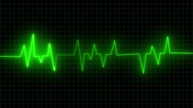 Green neon heart rate monitor pulse line moving across black grid background cinematic medical hospital equipment visualization video clip showing heartbeat rhythm animation.