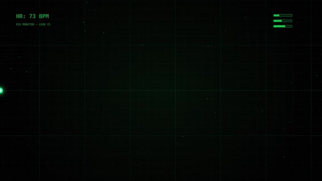 Digital Heartbeat Ekg Monitor Screen Displaying Green Signal Pulse On Dark Background