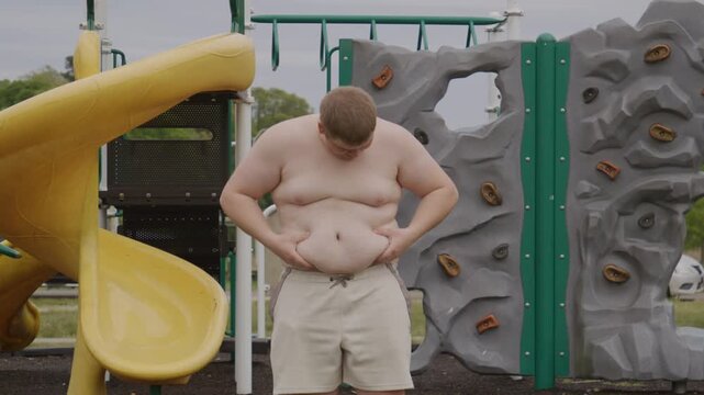 Obese male stands at outdoor park. Overweight male holds belly outdoors. Obese body shows visible belly weight. Young male is obese outdoors. Park scene includes obese body.