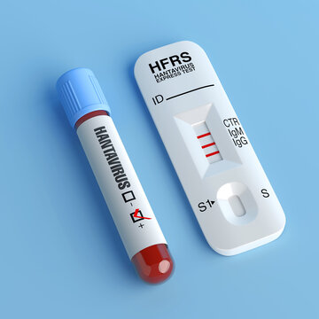 Hantavirus Diagnostic Testing Concept. Positive HFRS Rapid Test Cassette With IgM And IgG Lines Beside Labeled Blood Sample Tube. 3d Rendering