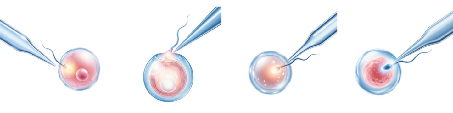 Four stages of laboratory assisted in vitro fertilization process