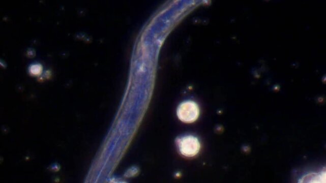 A roundworm on a dark background, viewed under a microscope, slowly wriggles sideways.