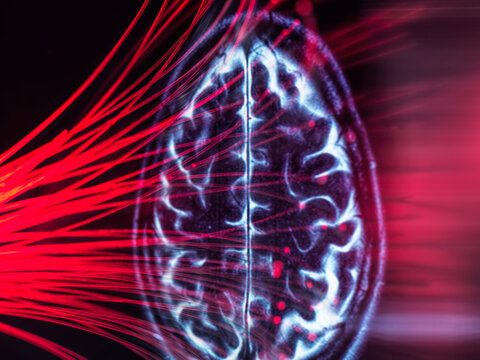 Brain scan receiving AI data via glowing fiber optic
