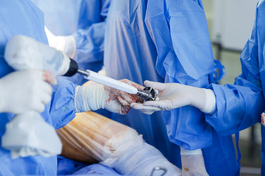 Surgical Team Performing Hip Replacement Surgery in Operating Room