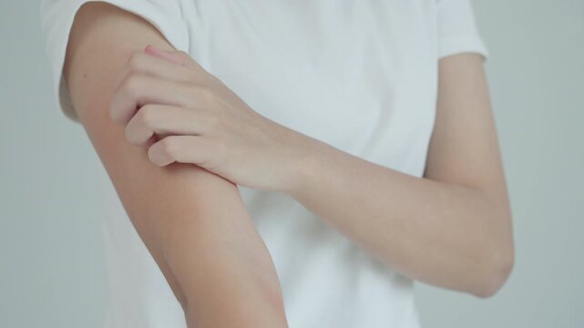 skin problem and beauty. woman scratch body has itchy skin from skin allergic, steroid allergy, sensitive skin, red from sunburn, chemical allergy, rash, insect bites, Seborrheic Dermatitis.