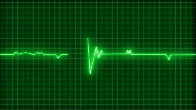 Glowing neon ecg heartbeat waveform on grid background animation