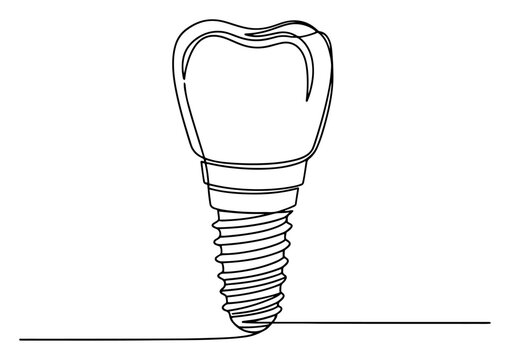 Dental implant screw with a tooth crown in continuous line art style