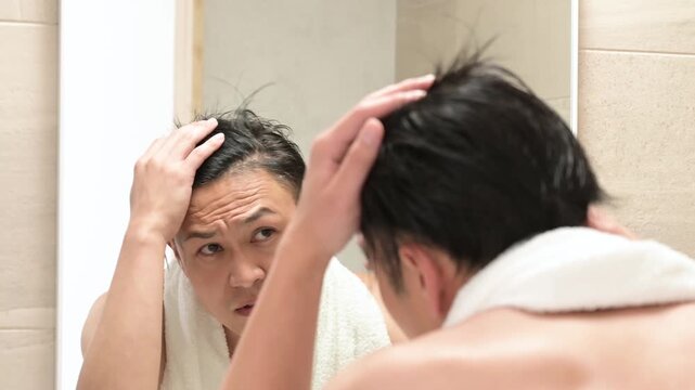 髪の生え際を気にする日本人男性