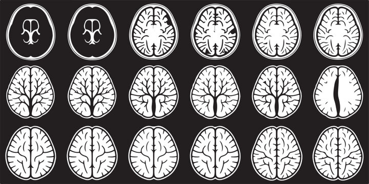Human brain anatomy set showing various cross section slices of cortex and cerebral structures for medical research diagnostic.