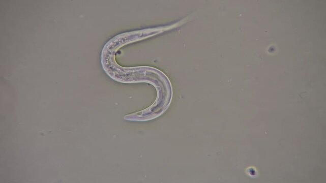 Nematodes and bacterial biofilm sampled from a household sink under the microscope 