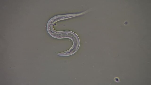 Nematodes and bacterial biofilm sampled from a household sink under the microscope 