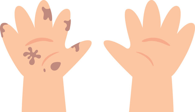 Dirty hands and clean hands