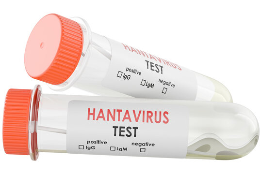 Two hantavirus test specimen tubes, transparent background.