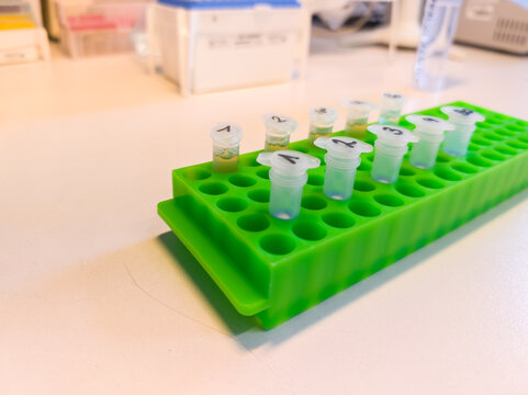 Brussels, Belgium. Labeled microcentrifuge tubes containing DNA extraction samples in a laboratory rack.