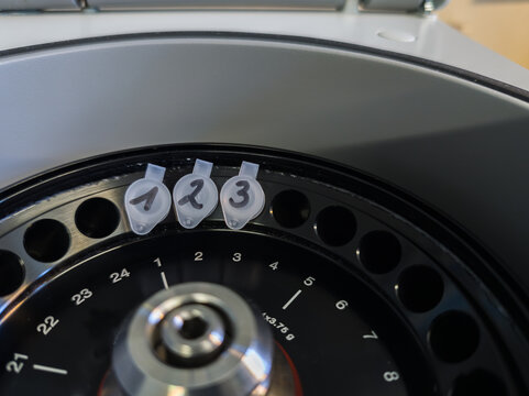 Brussels, Belgium. Labeled DNA sample microcentrifuge tubes loaded into laboratory centrifuge during extraction workflow