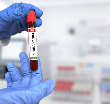 Doctor holds in his hand a blood test tube for Ebola virus with a positive result