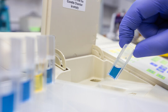 A quartz cuvette containing blue liquid in a scientist's hand during a laboratory analysis.