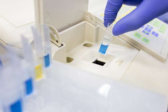 Optical analysis of substances using a spectrophotometer in a laboratory. Determination of optical density.