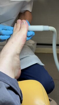 Close-up man foot pedicure diamond drill master wearing blue gloves working on toenail electric file smoothing callus salon lamp