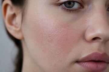 Fototapeta premium A close-up portrait of a young woman's face, highlighting her skin texture and features.