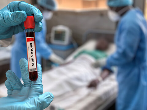 Doctor holds in his hand a blood test tube for Ebola virus with a positive result