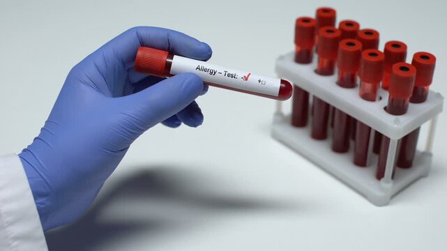 Close-up of a laboratory professional holding a blood sample tube labeled Negative Allergy Test. Concept of inflammation testing, diagnostic pathology, and laboratory medicine.