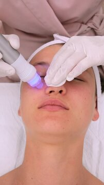 Professional cosmetologist performing a hydrafacial procedure on a young woman's face, using a modern device for deep cleaning, moisturizing, and skin rejuvenation in a beauty clinic. Vertical video