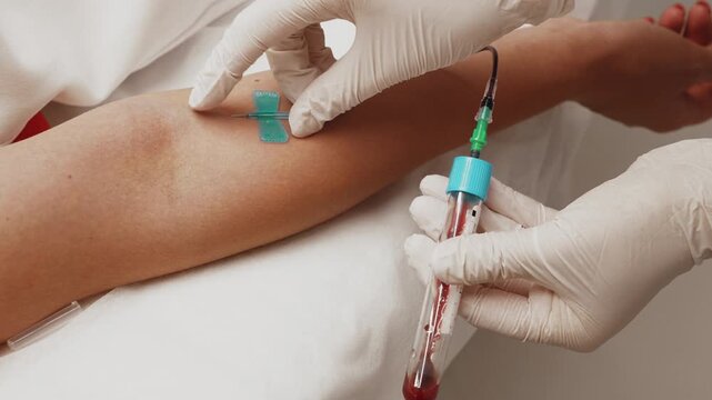 Healthcare professional collecting a blood sample from a patient's arm using a vacuum blood collection tube during a clinical procedure.