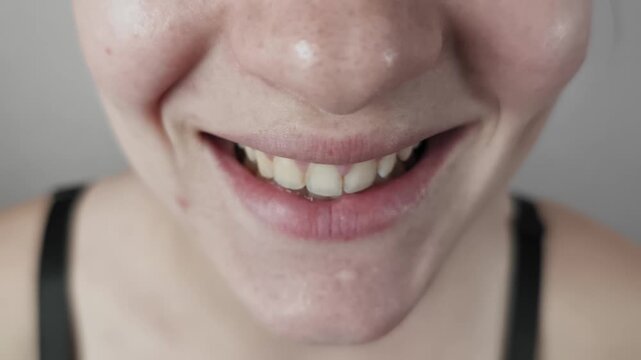 Extreme close-up captures a young female face smiling widely to reveal upper teeth. The shot emphasizes natural freckled skin texture and authentic imperfections in soft light.
