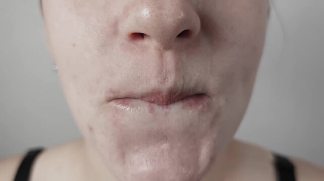 Extreme close-up shows a young female mouth licking glossy lips with a tongue. The macro footage highlights real imperfect skin texture with acne on the chin and around the mouth.