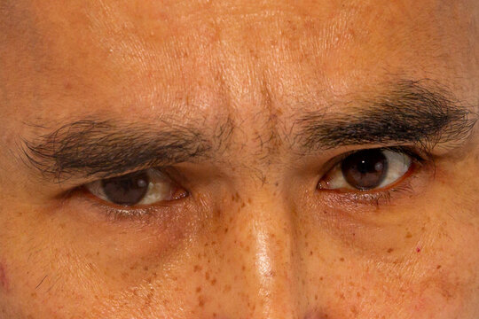 Close-up of judgmental eyes of Asian man. Intense stare showing disapproval and skepticism. Human emotion, facial expression, critique and judgment in psychological study.
