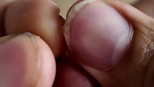 Extreme macro close up of a man picking at dry skin and cuticles around his dirty fingernails with visible black grime trapped underneath the nail beds.