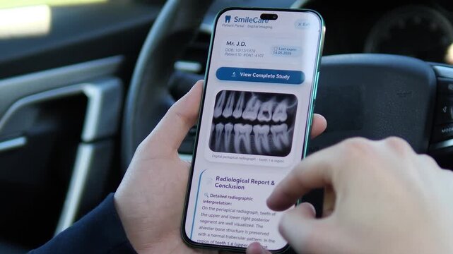 a user reviewing a dental x-ray and radiological report. The interface shows a detailed radiographic interpretation of the upper and lower teeth. Ideal for illustrating medical diagnostics, health
