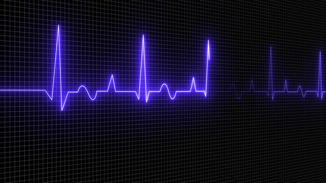 ECG monitor beating heart with a neon electrocardiogram. abstract neon heartbeat signal, ECG neon electrocardiogram pulse 4k video motion animation black background 