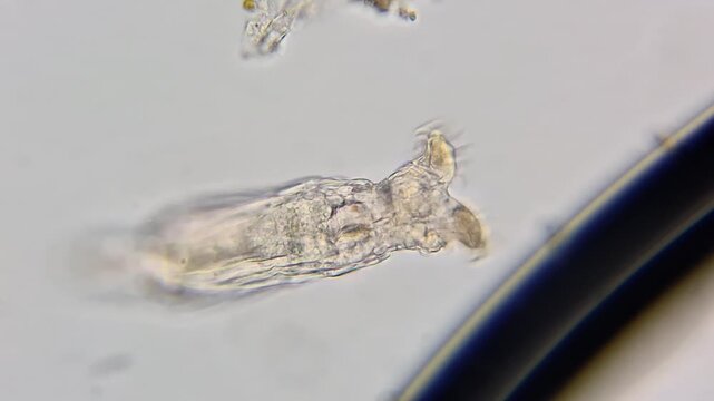 Microscopic view of a live rotifer moving in a freshwater sample 