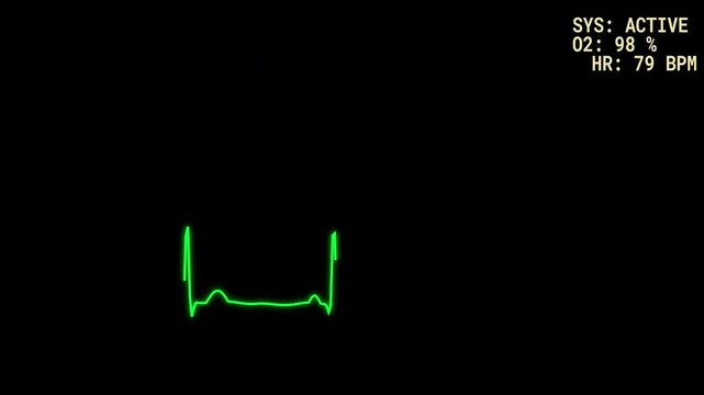 cardiograph recording | Vintage crt display of medical heart monitor with green pulse lines. Suitable for healthcare, medical, technology, and vintagethemed designs.