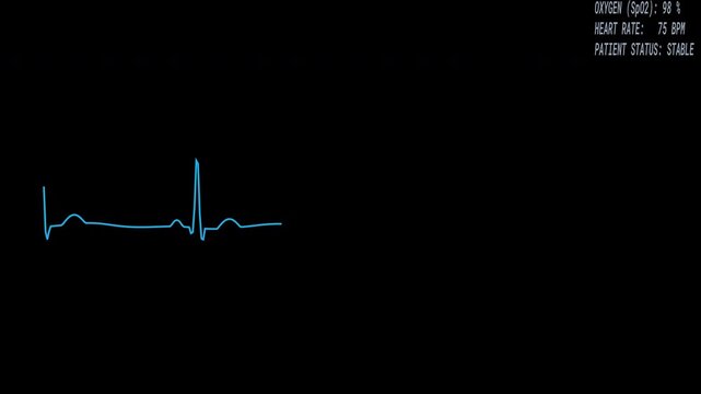 cardiograph recording | Digital flat ui design with stable blue medical heart rhythm monitor readings, on transparent background suitable for healthcare websites, medical apps, and presentations.