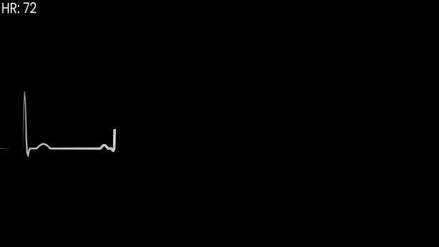 cardiograph recording | Minimalist pattern of pure white electrocardiogram line, on transparent background suitable for healthcare presentations or medical websites as a subtle design element.
