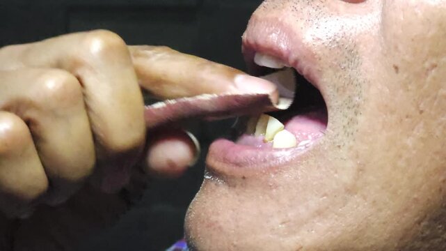 Macro shot of a man shaping his homemade artificial tooth with a strip of sandpaper in his mouth
