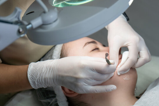 Thread Lifting, Face, Beauty Salon: Precise Thread Lifting Procedure by Beautician, Close-up