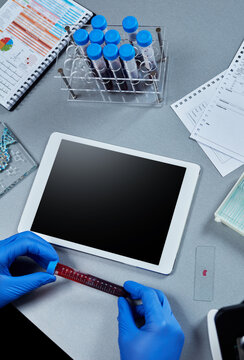 Blood sample and tablet on laboratory desk, clinical testing and healthcare technology