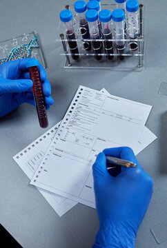 Blood sample test tube and laboratory report form, clinical diagnostics documentation and medical research concept