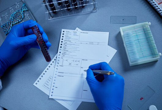 Laboratory technician recording diagnostic results with blood sample, clinical research documentation and healthcare analysis process