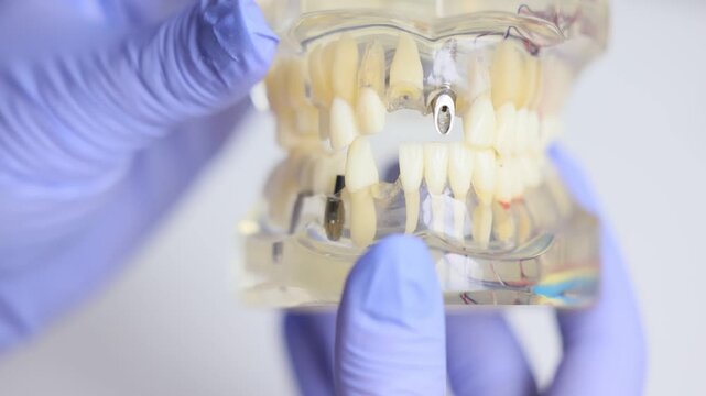 Transparent dental typodont showing tooth roots for anatomy study
