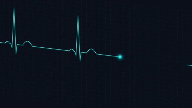 EKG monitor displays vital heart rhythm reading on screen